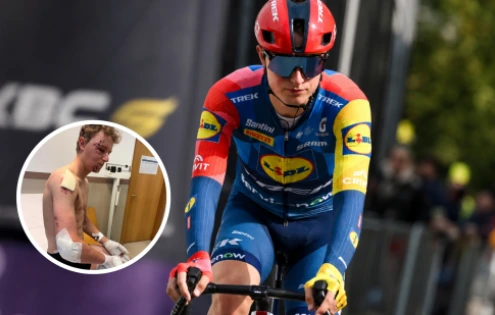 Dánský supertalent ukázal děsivé následky pádu. Po nehodě při 80 km/h skončil v nemocnici