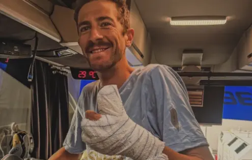 Hrůzný pád na Tour de France. Chris Harper po nehodě přišel o část palce