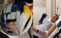 Zoe Backstedt po pádu: „Helma mi zachránila život“