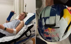 Zoe Backstedtová po zlomenině zápěstí plánuje brzký návrat a útok na MS