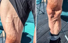 Takto vypadají nohy cyklisty po dvou týdnech na Tour. Co stojí za extrémním vyrýsováním?